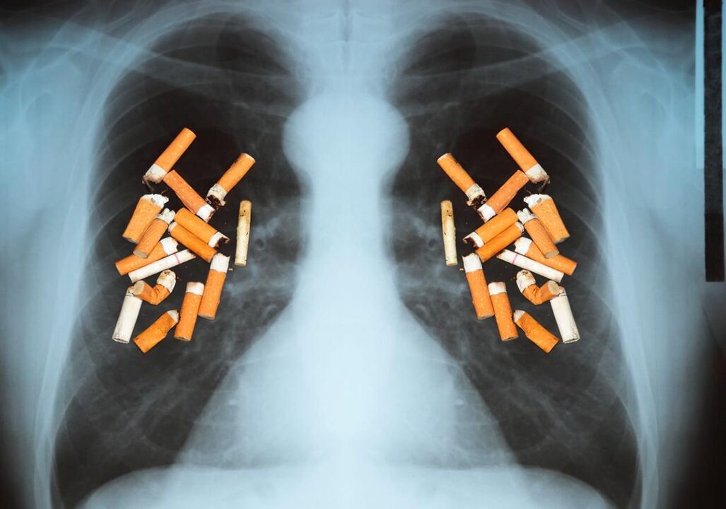 Kako cigarete vplivajo na pljuča